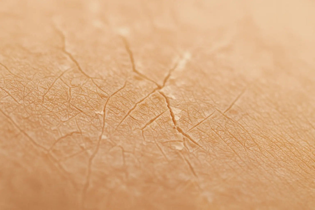 Vlaženje suhe kože: ali so olja in masla dovolj? - Skinfairytale