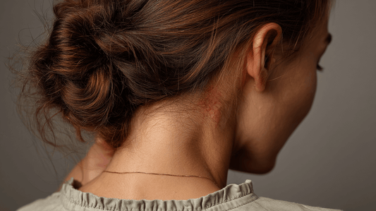 Problematično lasišče